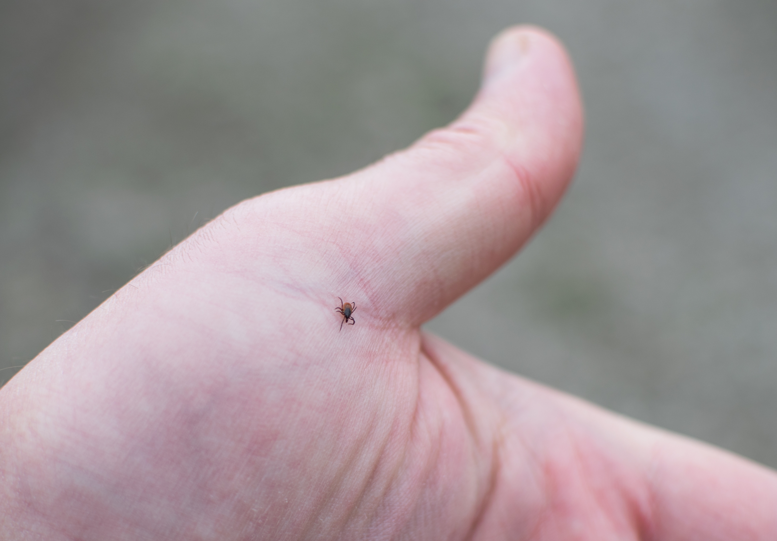 A deer tick on a hand.